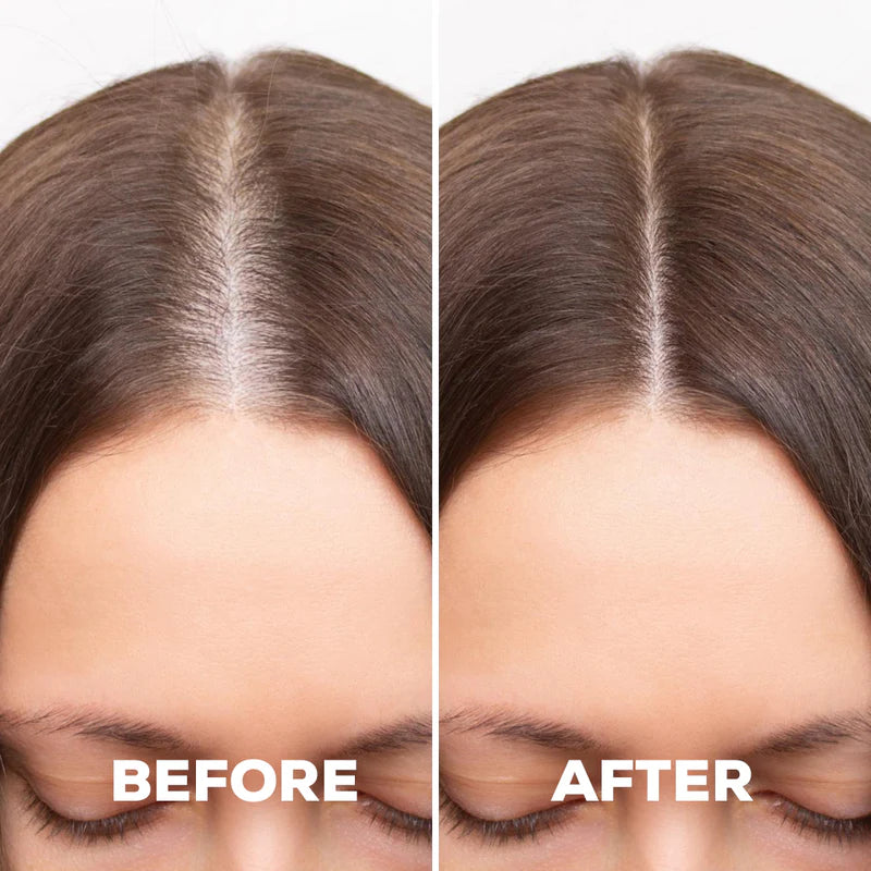 Derma Roller (Boost Serum Penetration)