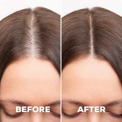 Derma Roller (Boost Serum Penetration)