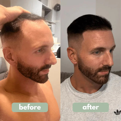 Rosemary Hair Serum Roll-On (Ultimate Combo)
